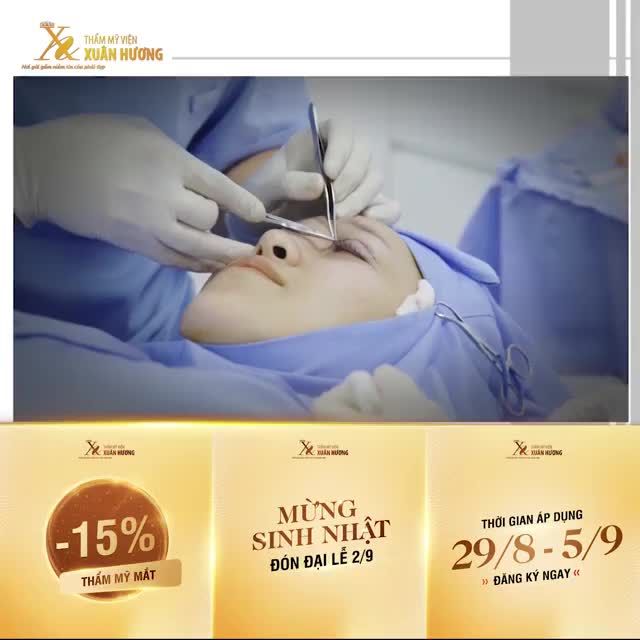 MẮT TO TRÒN - NẾP MÍ ĐẸP TỰ NHIÊN CHỈ SAU 5 NGÀY NHƯ CA SĨ MINH NGỌC - ĐẾN LƯỢT BẠN !!!