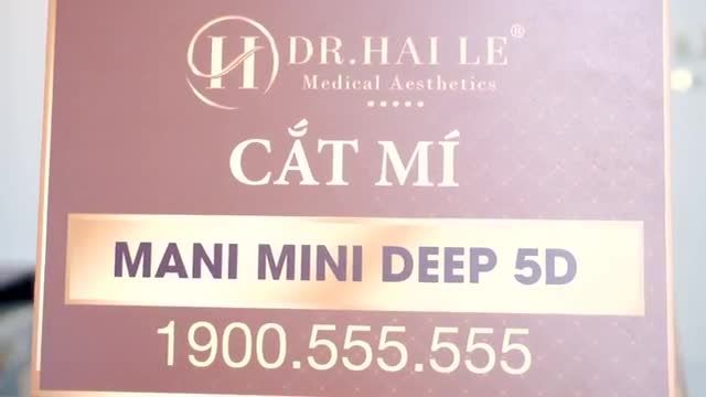 Những điều cần biết về phương pháp Cắt mí Mani Open Deep 5D