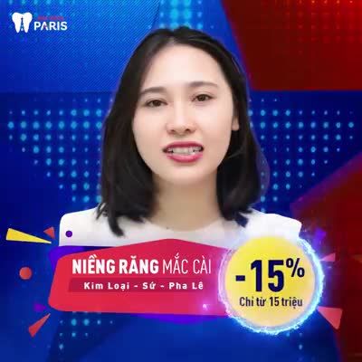 NIỀNG RĂNG 3D SPEED
 MỪNG ĐẠI LỄ GIÁ THÍCH MÊ