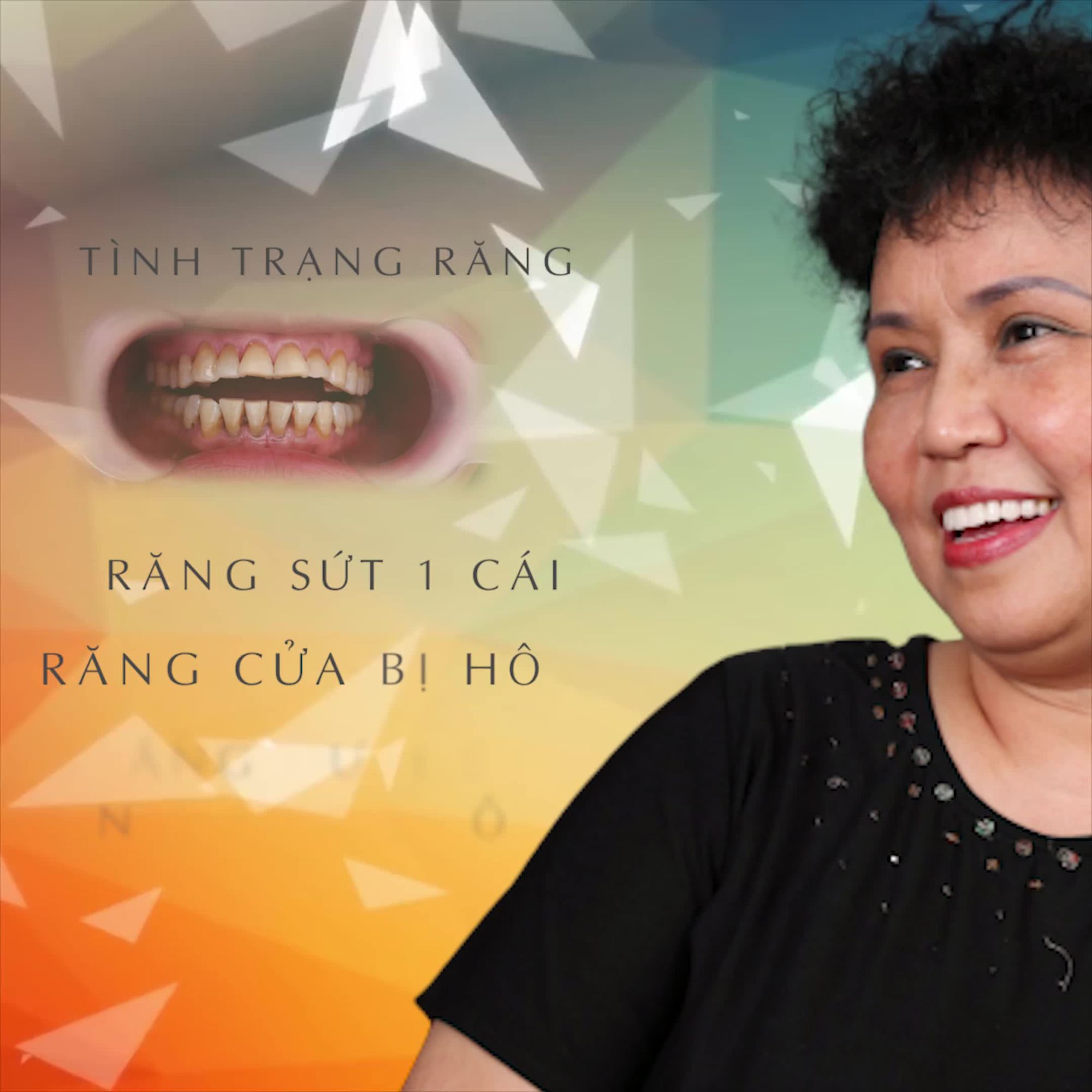 RẤT CẢM ƠN CÁC BÁC SĨ TẠI SHINBI ĐÃ GIÚP TÔI CÓ HÀM RĂNG RẤT ƯNG Ý VỚI DỊCH VỤ LÀM RĂNG SỨ THẨM MỸ