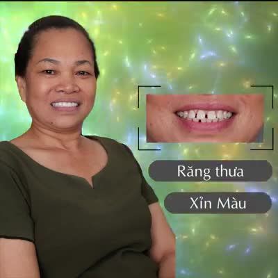 2 LÝ DO ĐẶC BIỆT ĐÃ GIÚP CHỊ LIÊN LẤY LẠI NỤ CƯỜI TỰ TIN