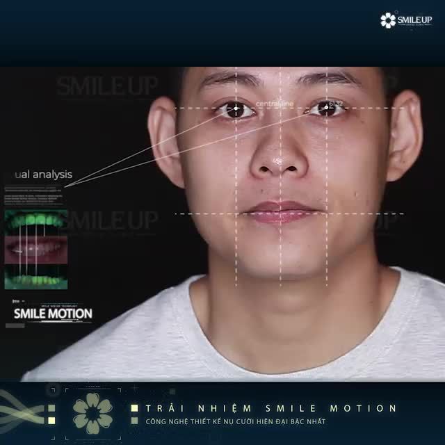 DIỄN VIÊN TÙNG ANH VÀ MÀN “BIẾN HÓA” NỤ CƯỜI SIÊU CUỐN HÚT TẠI SMILE UP