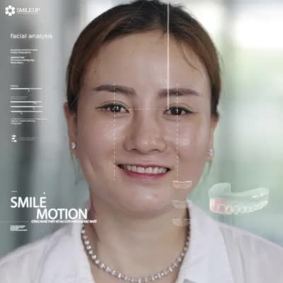 LỘ DIỆN" ĐỘC CHIÊU XINH ĐẸP HÚT MẮT CHỈ SAU 2 NGÀY