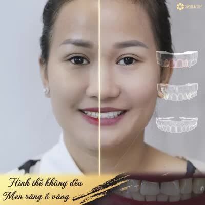 SỞ HỮU NGAY BÍ QUYẾT ĐẸP HÚT HỒN CHỈ TRONG 2H, CLICK XEM TIẾP NGAY