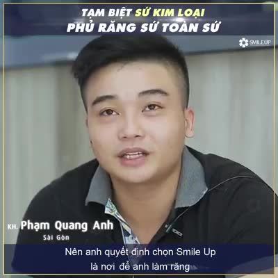 TẠM BIỆT SỨ KIM LOẠI - PHỦ RĂNG SỨ TOÀN SỨ TẠI SMILE UP