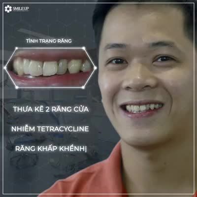 BẠN MUỐN NỔI BẬT "BÍ QUYẾT" NẰM Ở DƯỚI ĐÂY