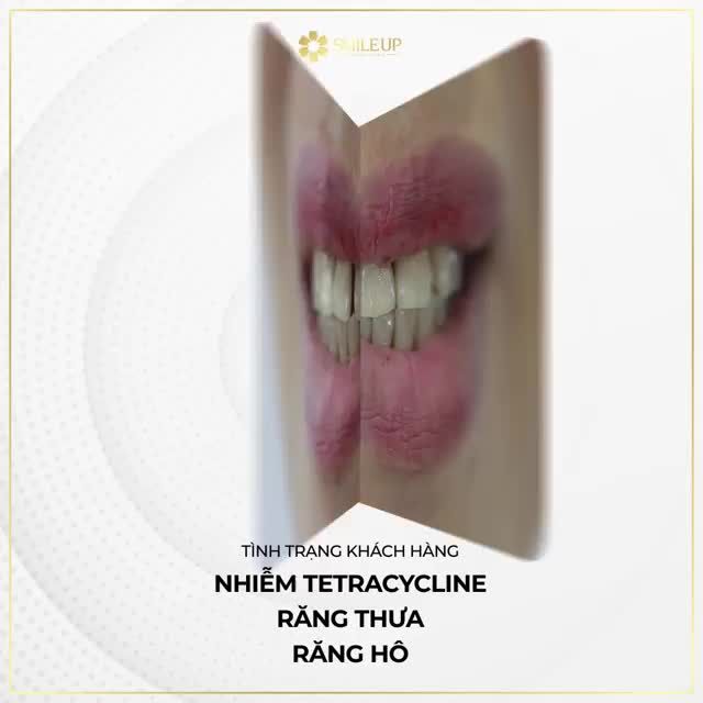 ĐÚNG NƠI ĐÚNG THỜI ĐIỂM...TRẺ RA HẲN 5 TUỔI?