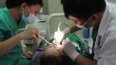 [Trực tiếp] Tiến sĩ, bác sĩ Hà Ngọc Chiều chỉnh sửa tạo điểm bám, chuẩn bị dán 20 răng sứ Veneer Lisi Press - Mỹ (bảo hành 20 năm)
