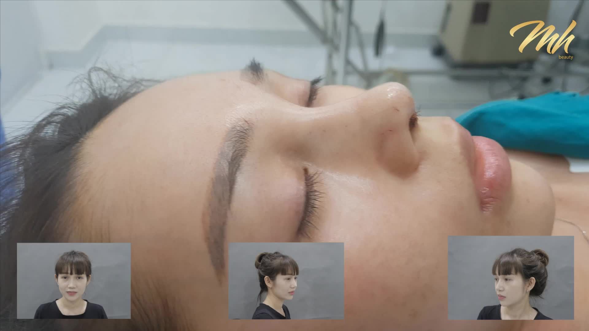 TẠI SAO BẠN KHÔNG ĐẸP HƠN MỌI NGƯỜI ?