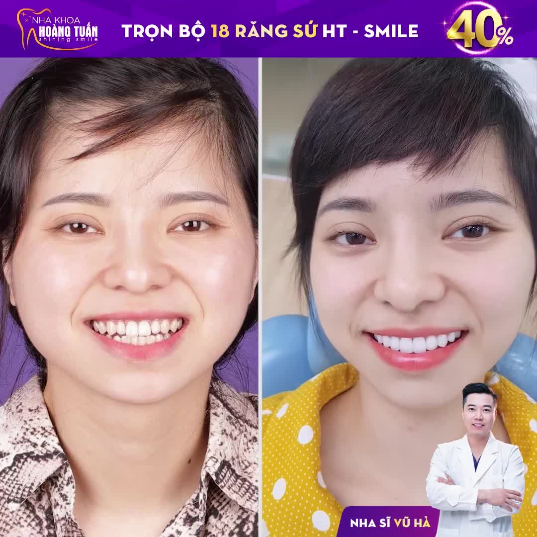 CHÀO MỪNG QUỐC KHÁNH 2/9 - ƯU ĐÃI HẤP DẪN - NHÂN ĐÔI NIỀM VUI‼️