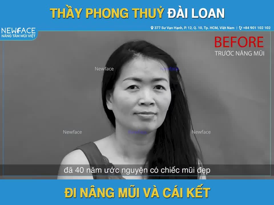 THẦY PHONG THỦY ĐÀI LOAN NÂNG MŨI SỤN SƯỜN VÀ CÁI KẾT