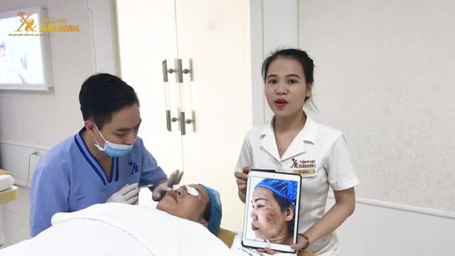 NÁM HỖN HỢP KHÓ CHỮA ĐẾN ĐÂU CŨNG HẾT SẠCH SAU 5 BUỔI MELAS PICOSURE