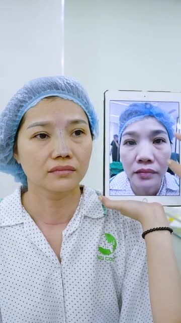 Từ Quảng Ngãi, chị Kh đã bay ra tận đây để thực hiện Nâng mũi High Line