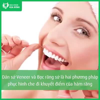 NÊN CHỌN DÁN SỨ VENEER HAY BỌC RĂNG SỨ