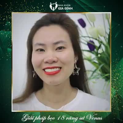 Nếu không xem hình ảnh răng trước khi làm thẩm mỹ chị Đỗ, hẳn là mọi người sẽ khen chị ấy có nụ cười đẹp, hàm răng trắng