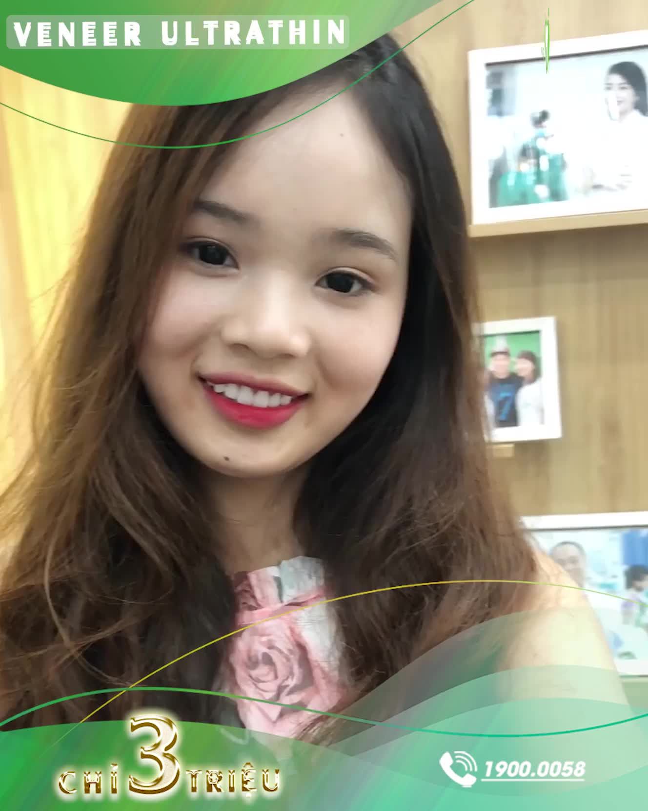 Cũng giống như rất nhiều KH đang muốn làm răng sứ, Hải Linh cũng mang trong mình nhiều nỗi lo