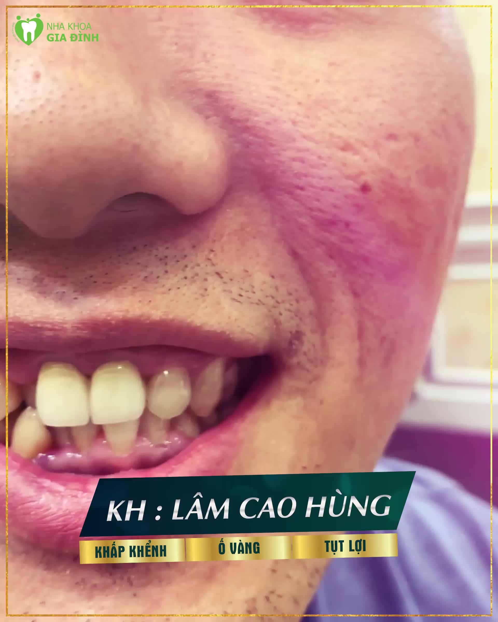 Ngày nay, đàn ông cũng cần phải chăm chút và làm đẹp cho bản thân mình.