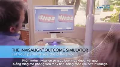 Mô phỏng kết quả niềng răng trên máy tính