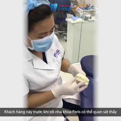 Răng thưa, khấp khểnh khiến bạn mất tự tin