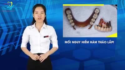 LIVESTREAM: ĐIỀU TRỊ CẮN NGƯỢC & CẮN CHÉO CHO KHÁCH HÀNG 16 TUỔI