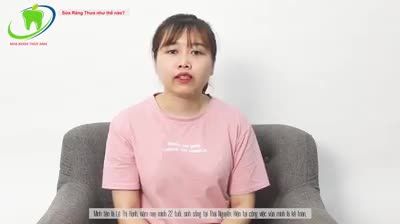 Răng thưa khắc phục bằng mặt dán sứ veneer.