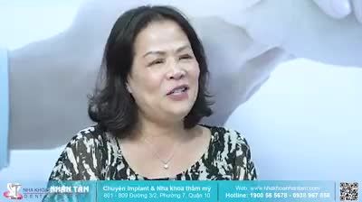 RĂNG SỨ TỰ NHIÊN NHƯ RĂNG THẬT