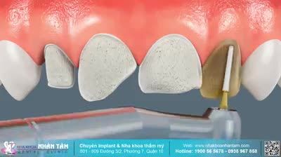 Bạn muốn đẹp tự nhiên?

 Nhưng không phải tự nhiên là đẹp