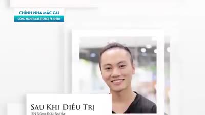 "Thực ra chủ yếu là vì em cảm thấy tự ti khi giao tiếp khi răng em có 2 răng kẹ.