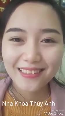 Tự tin khoe cá tính với hàm răng mới, nụ cười mới