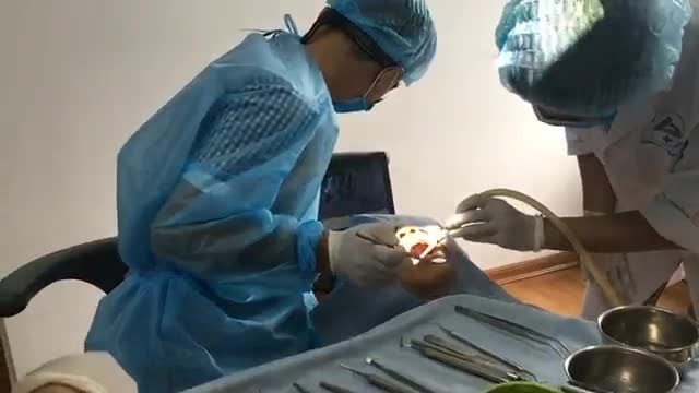 [LIVESTREAM]: TRỒNG RĂNG IMPLANT CHỈ 15- 20p nhanh chóng - không đau ngay tại BẮC NINH