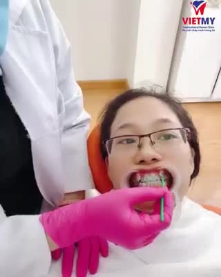 Chị khách hàng: Phạm Như Thủy, 27 tuổi đến với Nha khoa Quốc tế Việt Mỹ trong tình trạng răng mọc lệch lạc, khấp khểnh cả hai hàm.