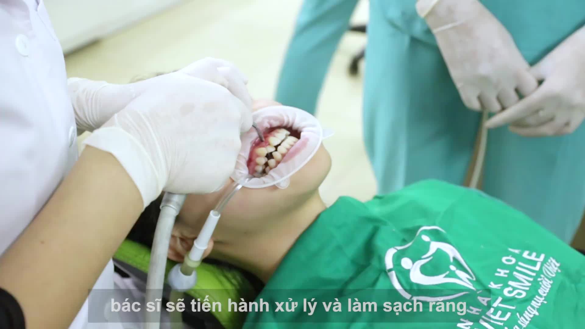 Chẳng ngại bước vào “Hội răng sắt”  Tự tin chờ đón nụ cười mới.