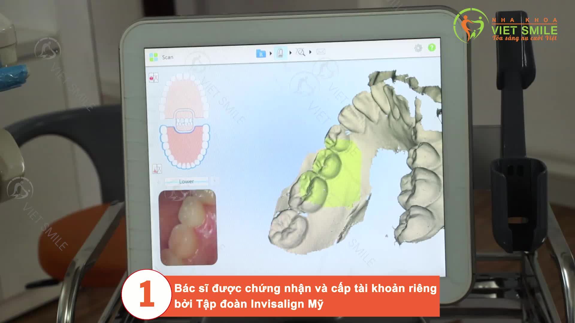 Bạn muốn niềng răng nhưng ngại đeo mắc cài ? 
Bạn muốn đảm bảo tính thẩm mỹ khi niềng răng ?