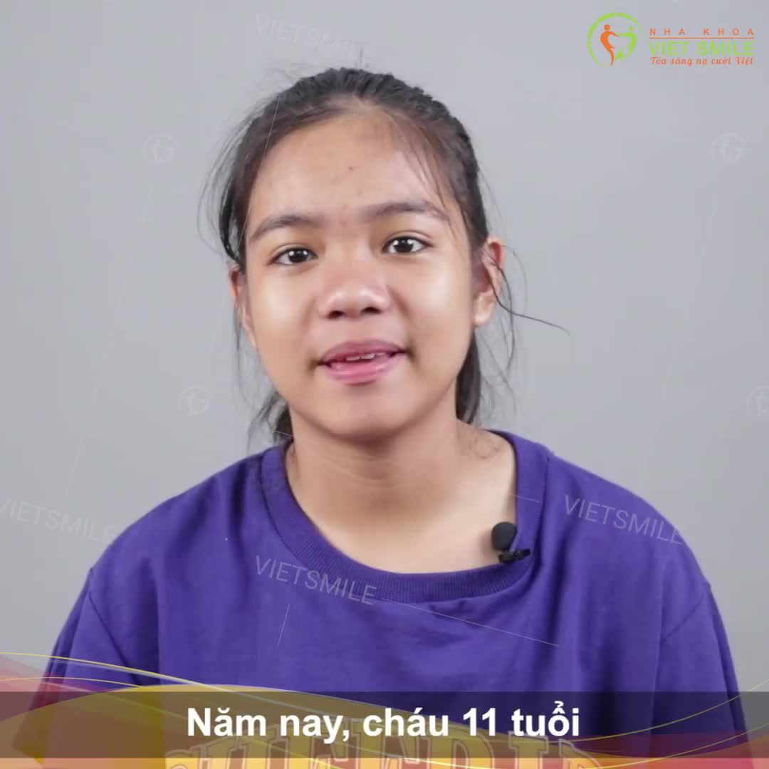 THÁO MẮC CÀI KHÁCH HÀNG 11 TUỔI