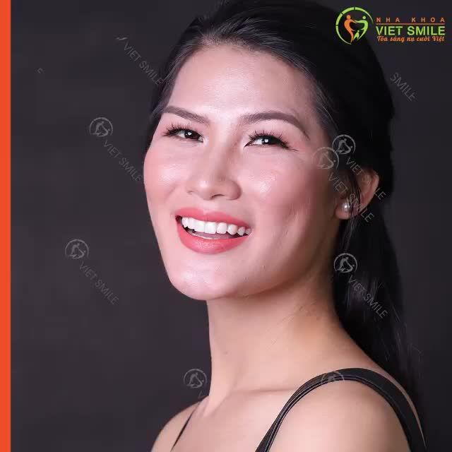 Muốn ĐẸP TỰ NHIÊN trước hết phải BẢO TOÀN NHỮNG ĐIỀU TỰ NHIÊN