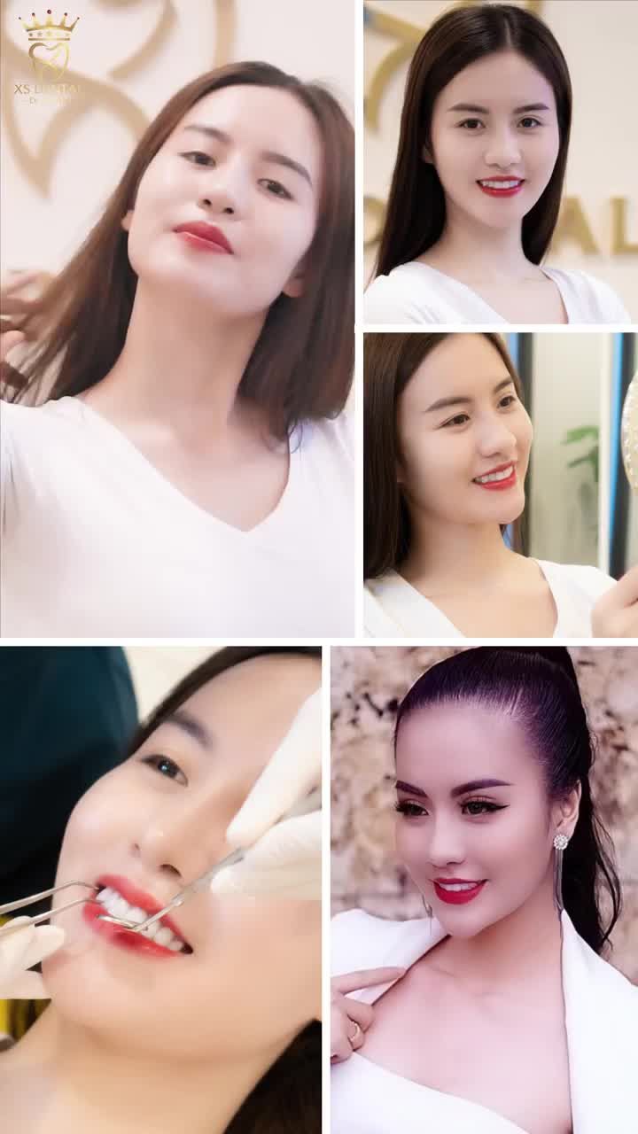 RĂNG SÁNG TRẮNG RẠNG NGỜI TRONG NẮNG