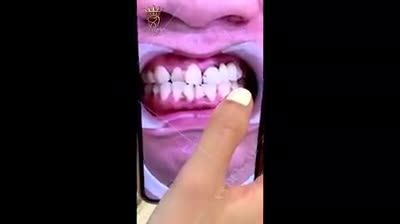 Khách hàng : Trần Hoàng Lân đến từ Bắc Giang