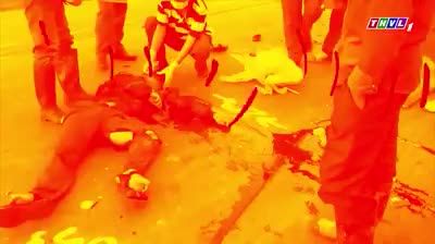 LỜI CẢNH BÁO] NGUY HIỂM KHÔN LƯỜNG KHI PHỤC HÌNH RĂNG SỨ KHÔNG ĐÚNG CÁCH