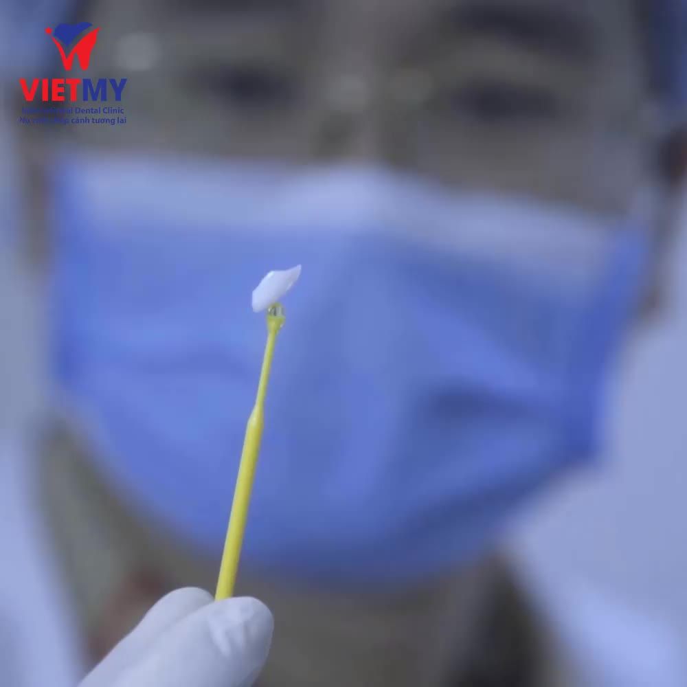 Dán sứ Veneer Diamond Emax giải pháp phục hình răng hiện đại, công nghệ độc quyền từ Nha khoa quốc tế Việt Mỹ với nhiều ưu điểm vượt trội