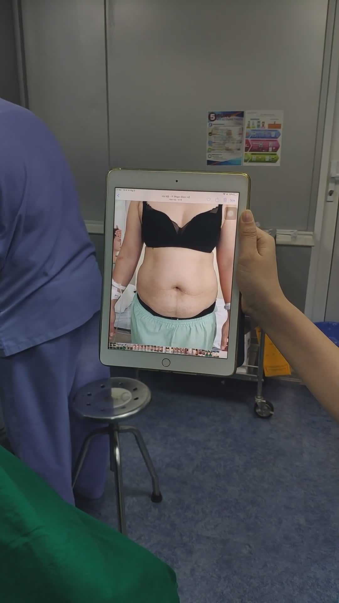 VÒNG 2 BÁNH BAO SAU 60PH THÀNH VÒNG EO CON KIẾN - NGẠC NHIÊN CHƯA