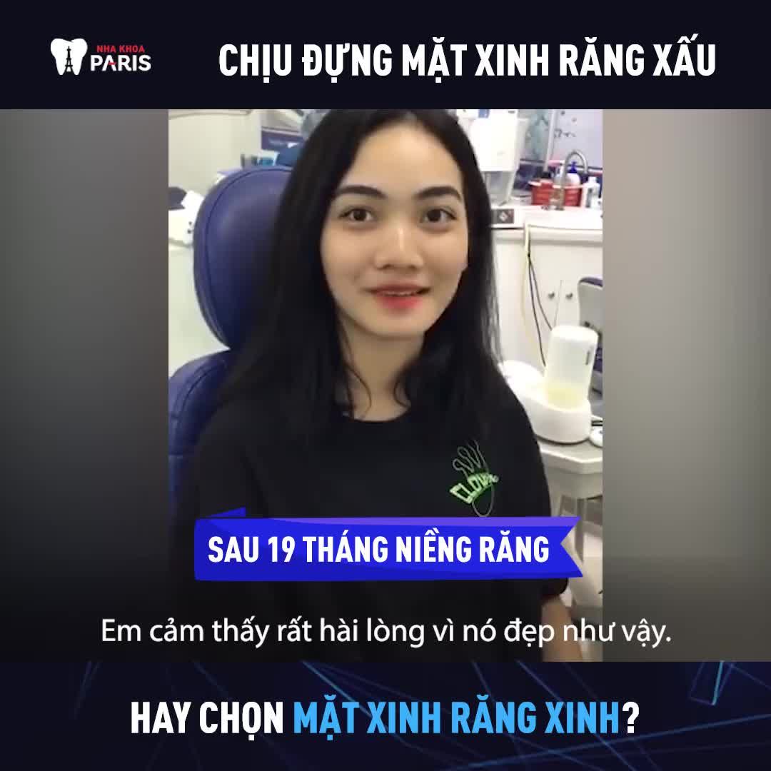 NIỀNG RĂNG  ngay thôi đừng chờ đợi bạn ơi