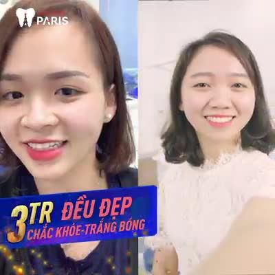 Cơ Hội Bọc Răng Sứ Chi Phí Tốt Nhất Năm
