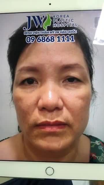 10 NĂM CHỊU ĐỰNG VỚI ÁNH MẮT U BUỒN VÀ CÁI KẾT BẤT NGỜ CHỈ SAU 60 PHÚT TẠI BỆNH VIỆN JW