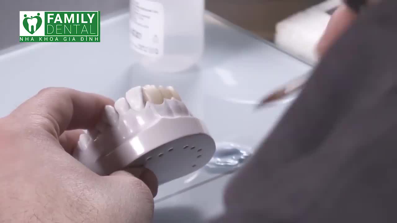 CHẾ TÁC CẦU RĂNG SỨ ĐẠT CHUẨN ĐẾN TỪNG MM