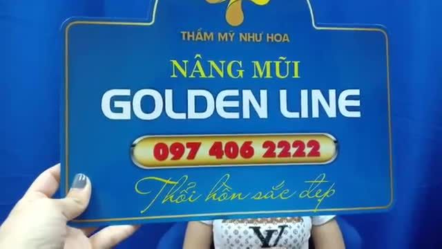 Khách hàng Vương Thị Bích Thìn trở lại tái khám và cắt chỉ sau 9 ngày Nâng mũi Golden Line + Xoá bọng mỡ mắt.