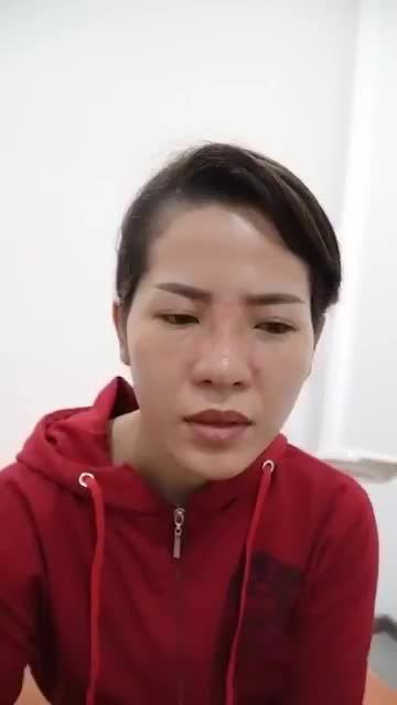 MŨI ĐẸP NGAY VỚI KẾT QUẢ SAU 10 NGÀY NÂNG MŨI CẤU TRÚC SỬA LẠI