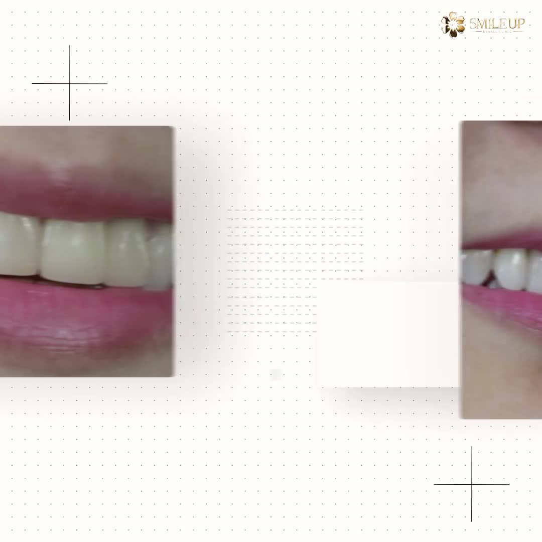 ĐẸP TỰ NHIÊN - NGỜI KHÍ CHẤT VỚI NỤ CƯỜI SMILE UP