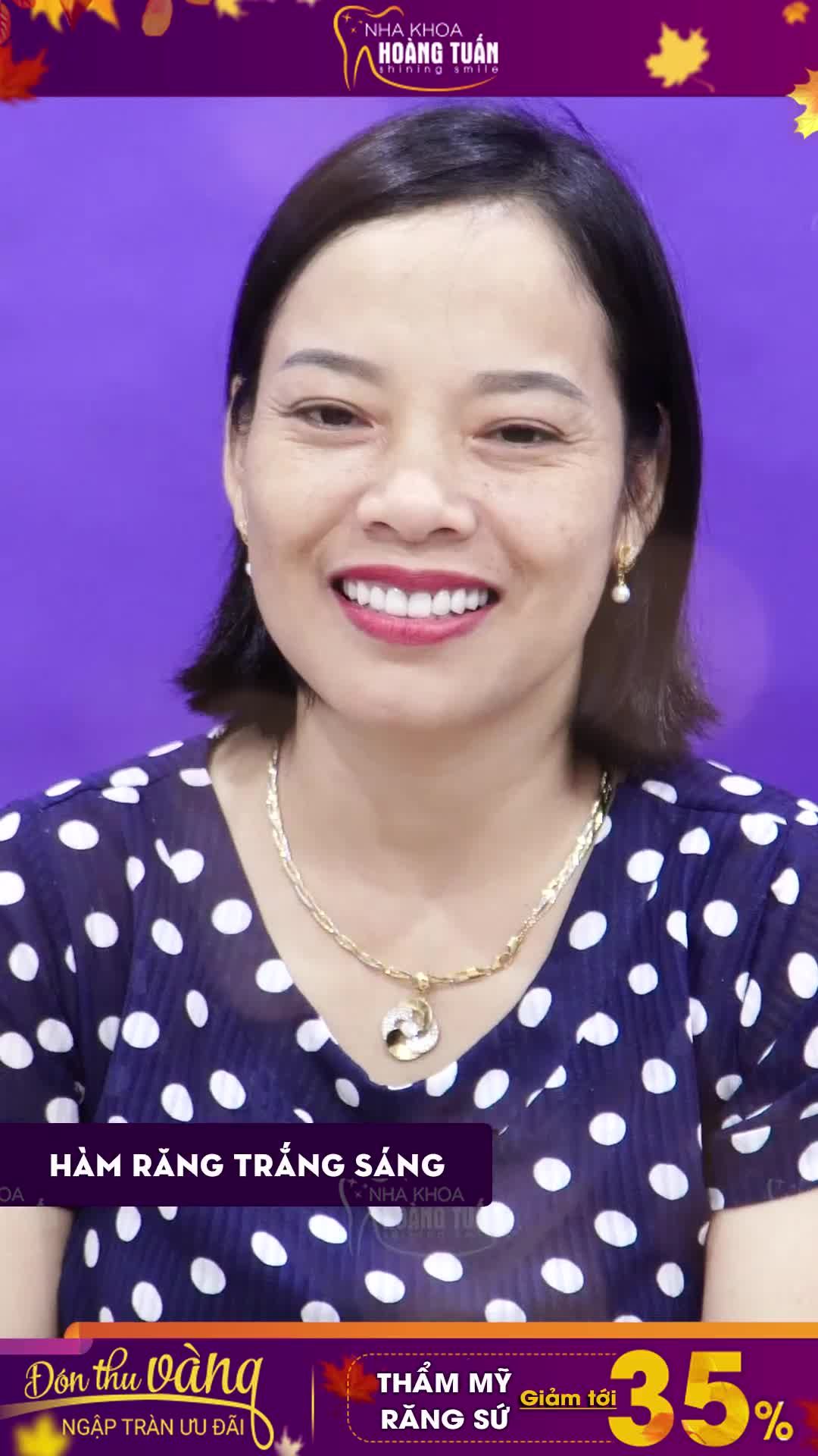 Răng sứ HT Smile – Đỉnh cao trong công nghệ bọc răng sứ - Thay đổi nụ cười cho mọi khách hàng