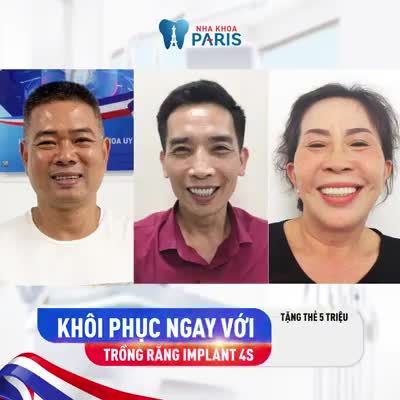 Tuần lễ vàng TRỒNG RĂNG IMPLANT: OFF 20% + Tặng thẻ 5 triệu