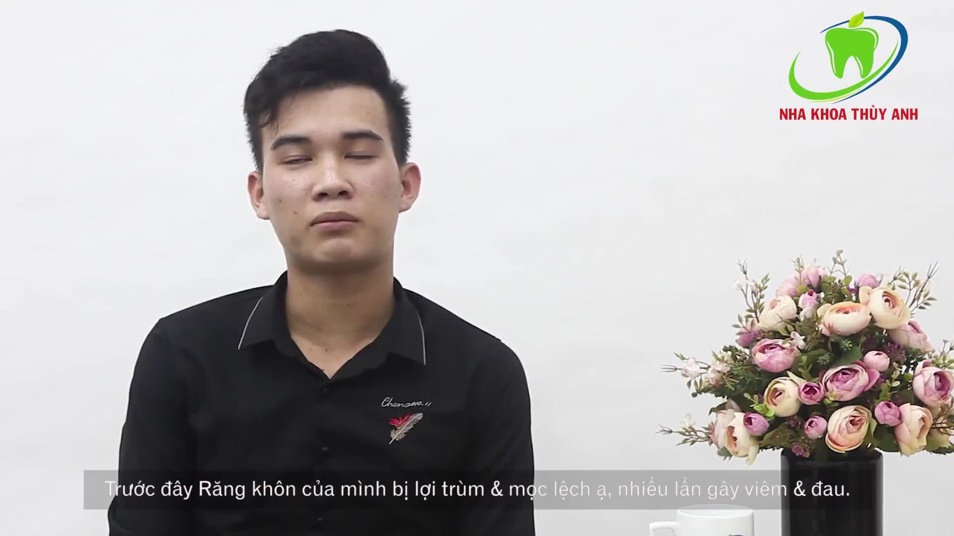 Chàng trai xứ Huế hiện đang đồng hành cùng với Nha Khoa Thùy Anh thực hiện niềng răng cải thiện răng thưa do có 1 chiếc răng kẹ giữa 2 răng cửa.